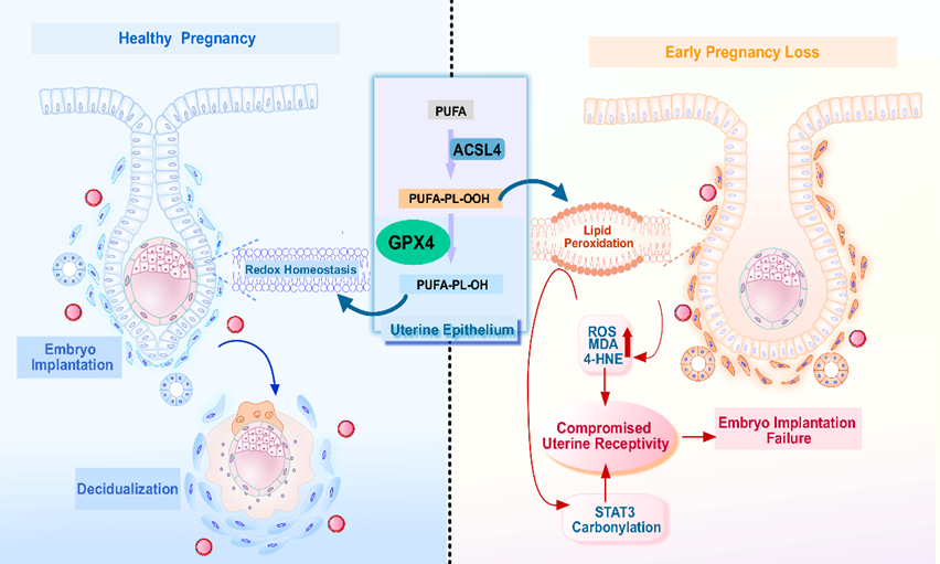 Adv Sci | 山东大学生殖医学研究团队揭示脂质过氧化调节子宫上皮容受态重塑和胚胎着床新机制